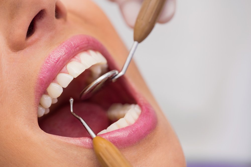 dentist-examining-female-patient-teeth